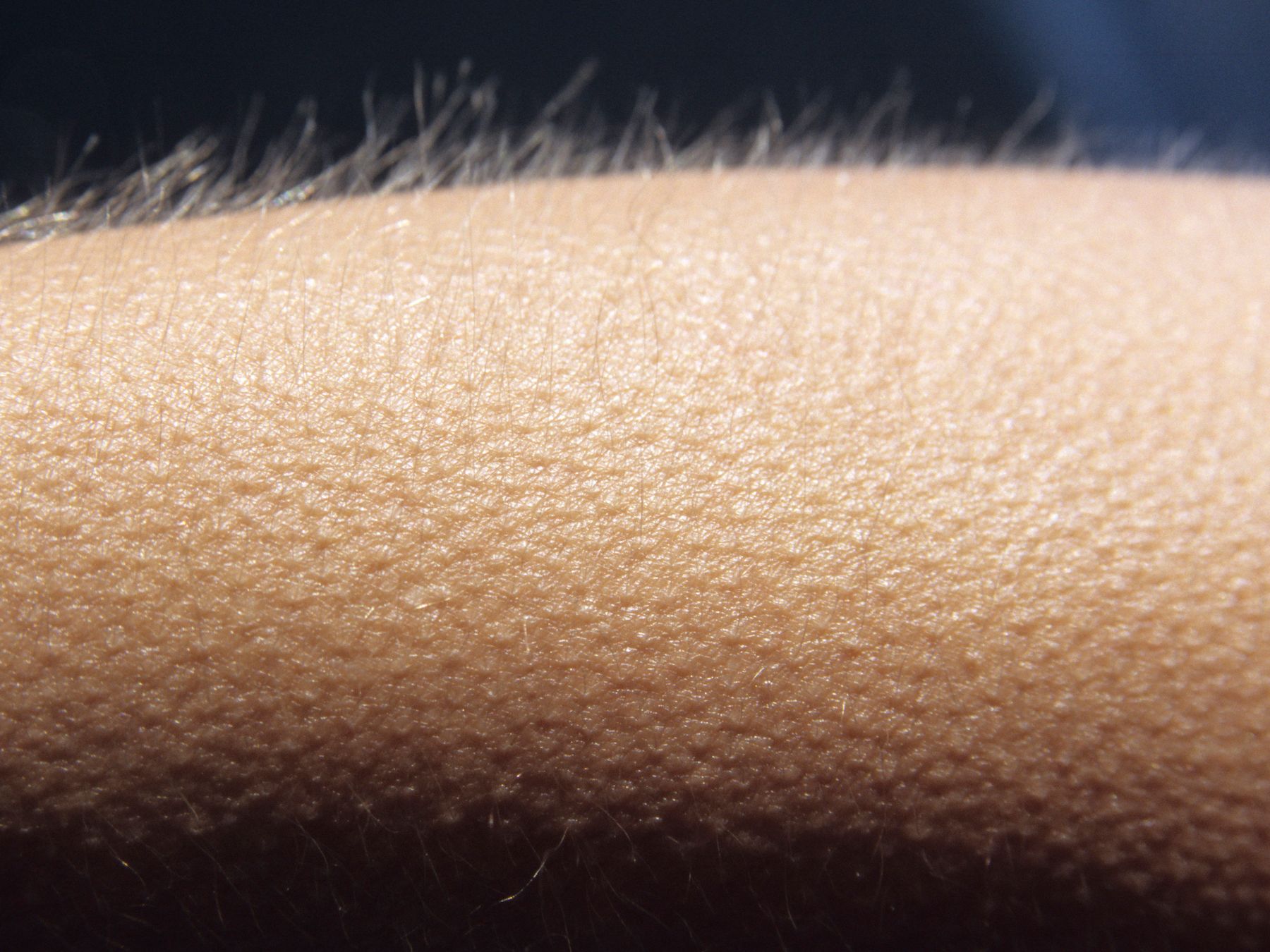 A close-up of goosebumps on skin.